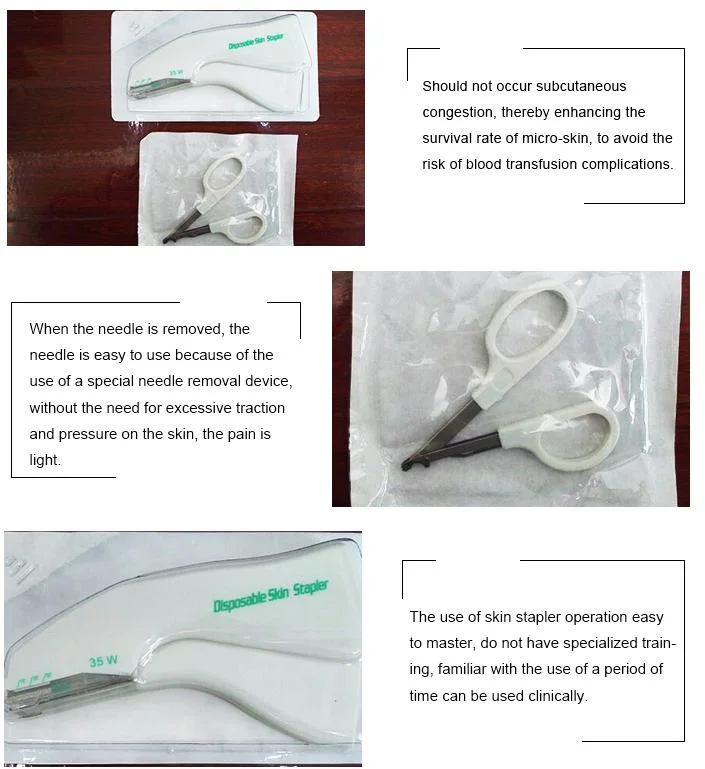 Disposable Medical Surgical Absorbable Skin Stapler